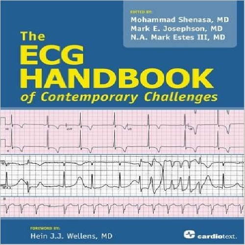 دانلود کتاب ECG Handbook of Contemporary Challenges زبان اصلی